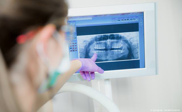 Digitales Röntgen: Weniger Strahlenbelastung und bessere Diagnose