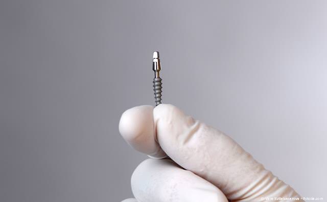 Minimalinvasives Implantat: Implantation ohne Schneiden und Nähen