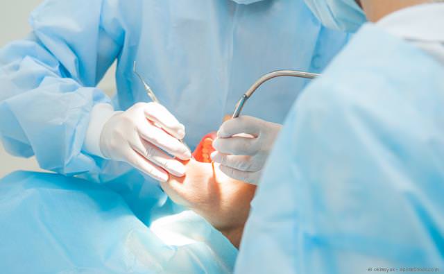 Oralchirurgische Eingriffe bei Erwachsenen